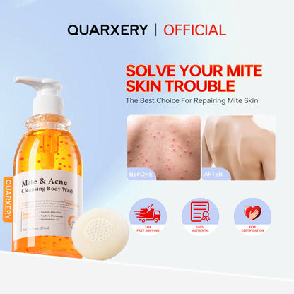 QUARXERY Mite & Acne Cleansing Body Wash
